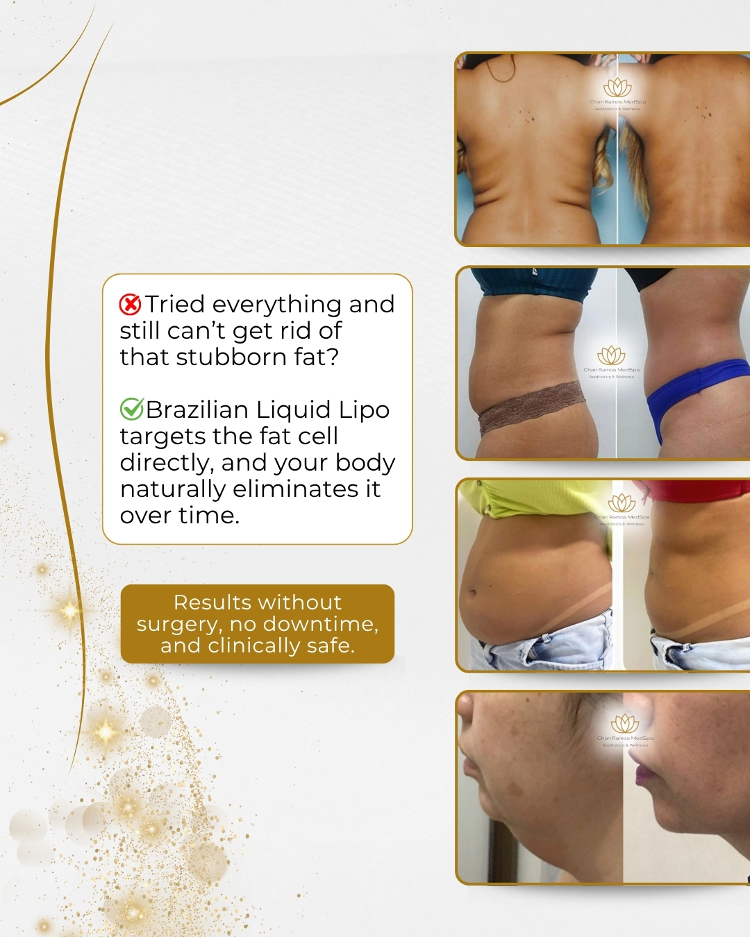 Brazilian Liquid Lipo: Non-Surgical Fat Reduction in Round Rock